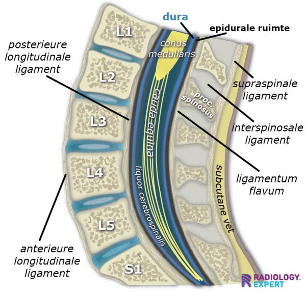 MRI Lumbale Wervelkolom mri-lumbale-wervelkolom